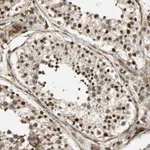 Atlas Antibodies Anti-ZBED9 Antibody