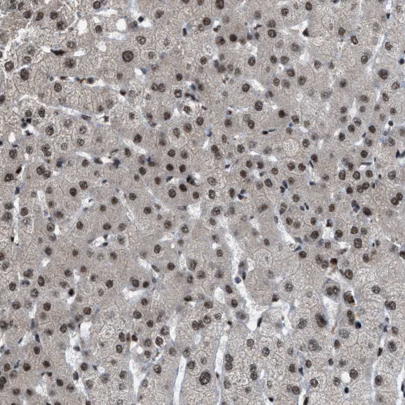 Atlas Antibodies Anti-ZBTB10 Antibody
