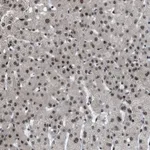 Atlas Antibodies Anti-ZBTB10 Antibody