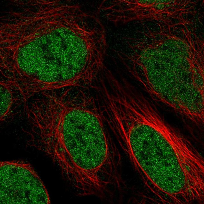 Atlas Antibodies Anti-ZBTB10 Antibody