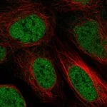 Atlas Antibodies Anti-ZBTB10 Antibody