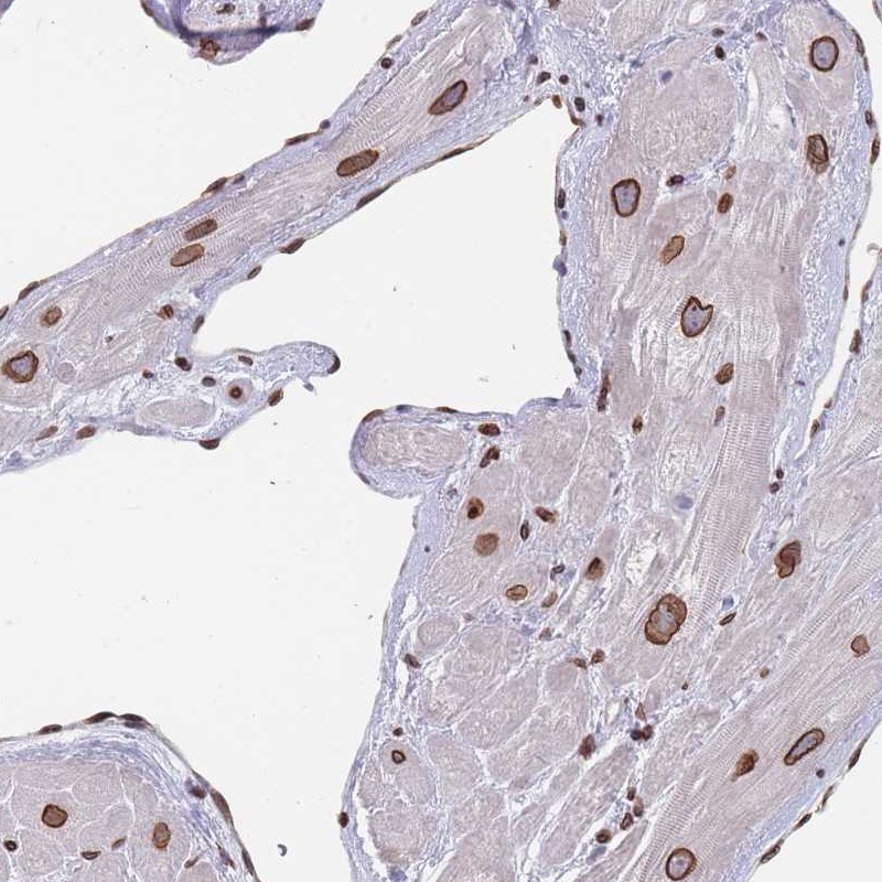 Atlas Antibodies Anti-ZBTB1 Antibody