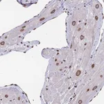 Atlas Antibodies Anti-ZBTB1 Antibody