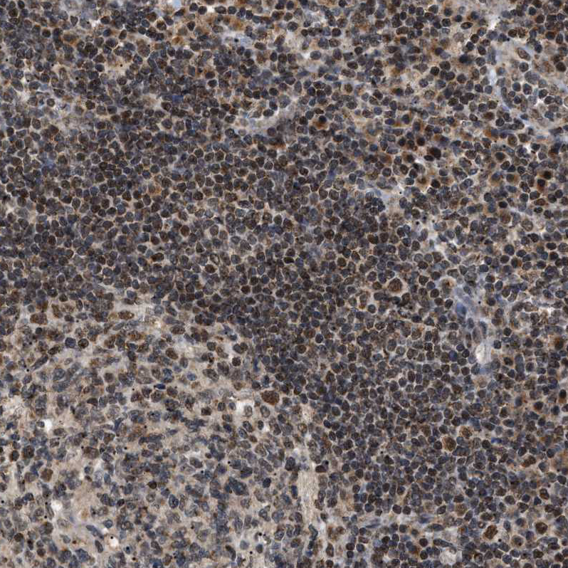 Atlas Antibodies Anti-ZBTB11 Antibody