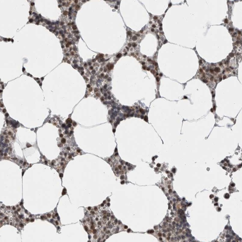 Atlas Antibodies Anti-ZBTB11 Antibody