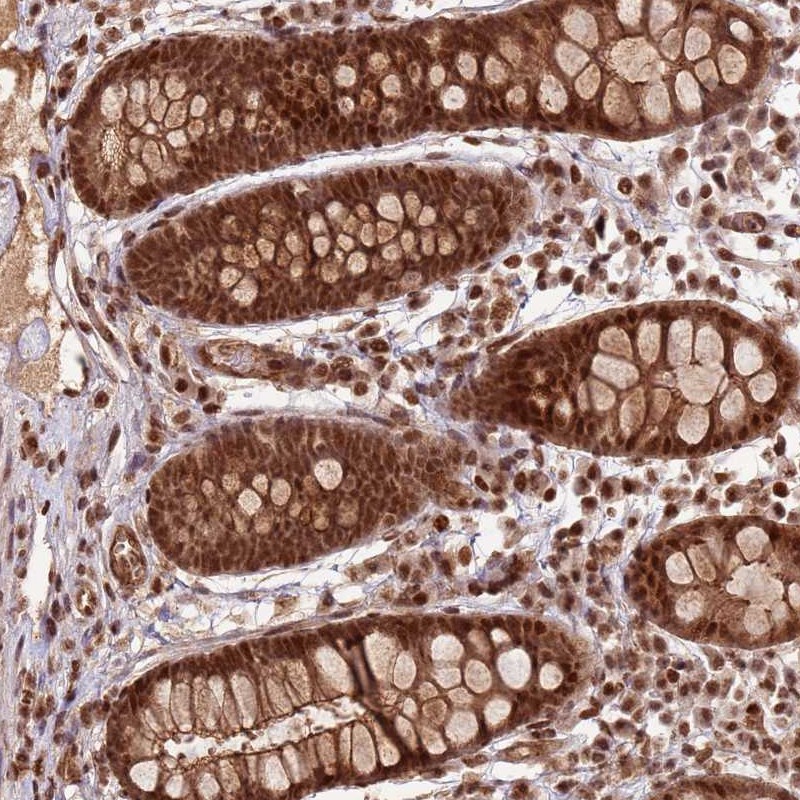 Atlas Antibodies Anti-ZBTB12 Antibody