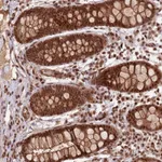 Atlas Antibodies Anti-ZBTB12 Antibody