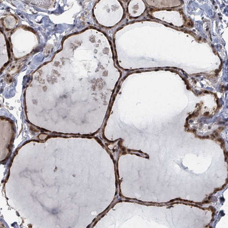 Atlas Antibodies Anti-ZBTB14 Antibody