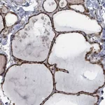 Atlas Antibodies Anti-ZBTB14 Antibody