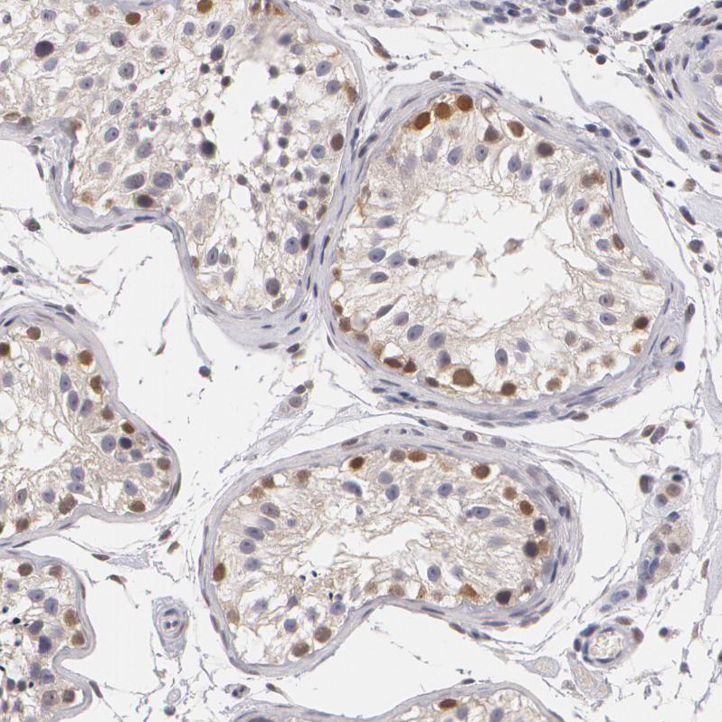 Atlas Antibodies Anti-ZBTB16 Antibody
