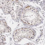 Atlas Antibodies Anti-ZBTB16 Antibody