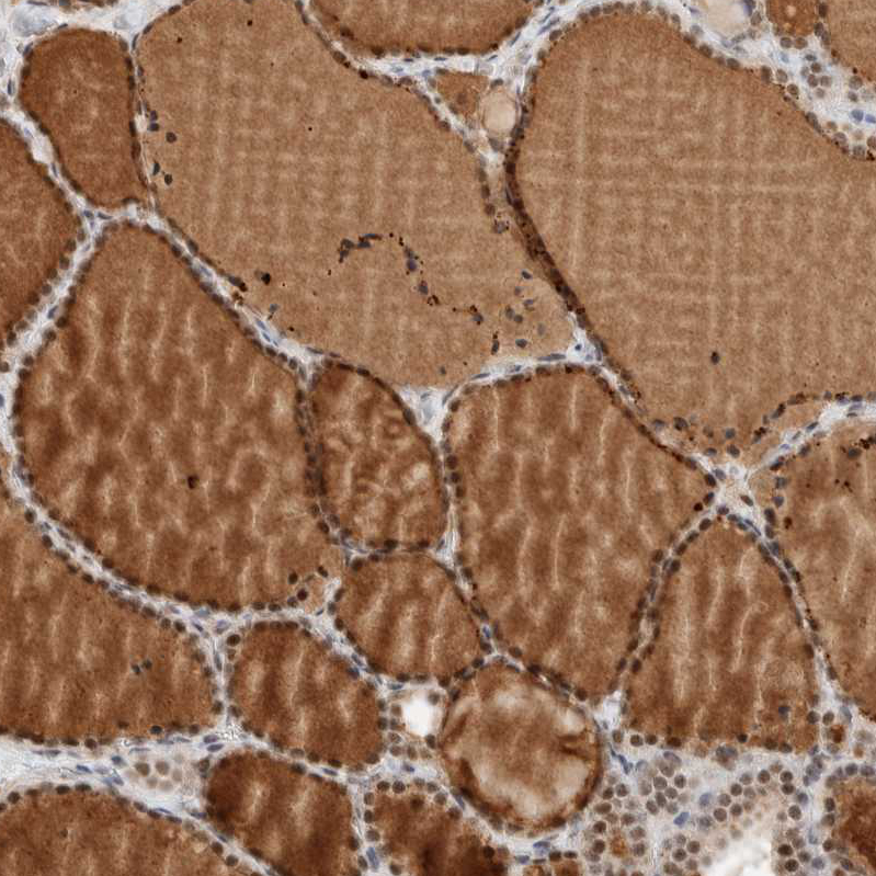 Atlas Antibodies Anti-ZBTB2 Antibody