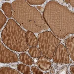 Atlas Antibodies Anti-ZBTB2 Antibody