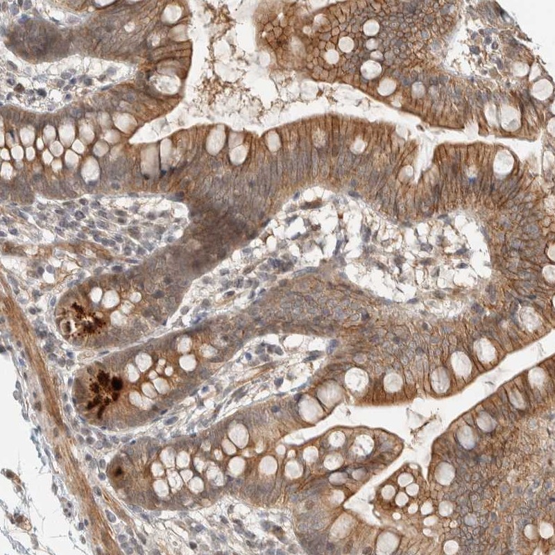 Atlas Antibodies Anti-ZBTB2 Antibody