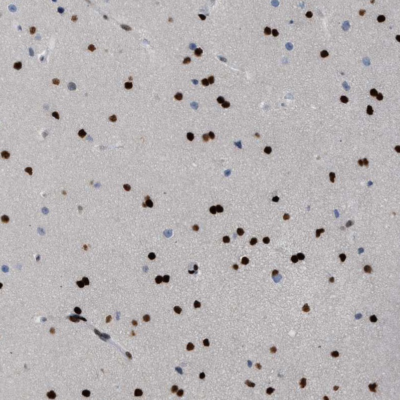 Atlas Antibodies Anti-ZBTB20 Antibody