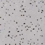 Atlas Antibodies Anti-ZBTB20 Antibody