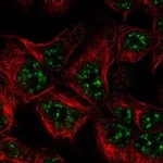 Atlas Antibodies Anti-ZBTB18 Antibody