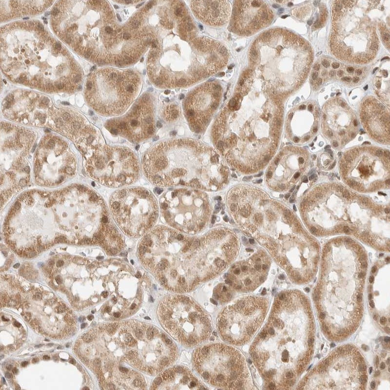 Atlas Antibodies Anti-ZBTB2 Antibody