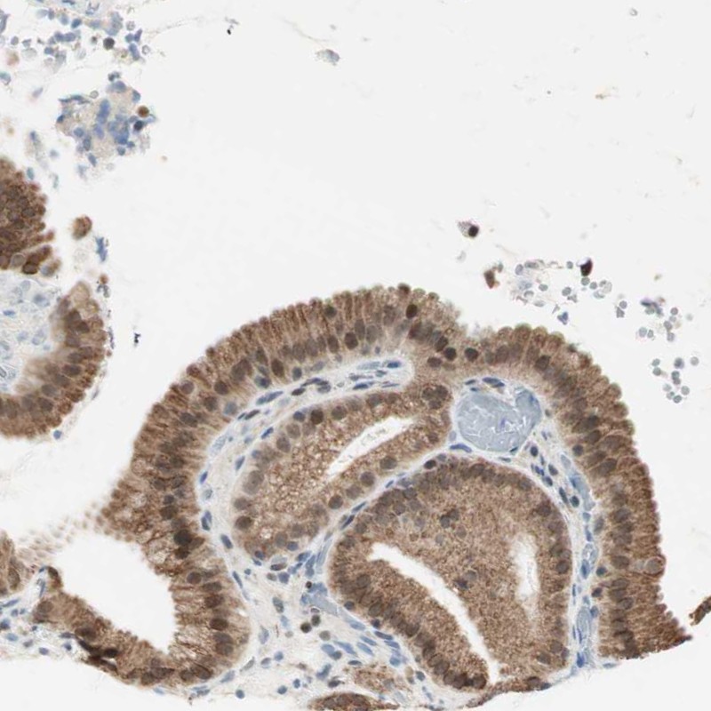 Atlas Antibodies Anti-ZBTB17 Antibody