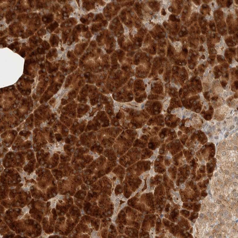 Atlas Antibodies Anti-ZBTB2 Antibody