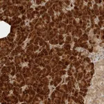 Atlas Antibodies Anti-ZBTB2 Antibody