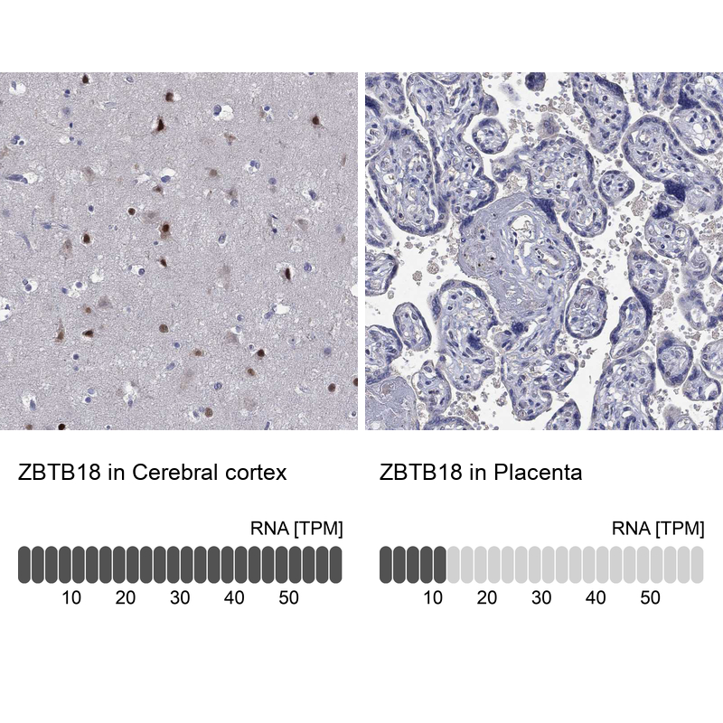Atlas Antibodies Anti-ZBTB18 Antibody