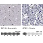 Atlas Antibodies Anti-ZBTB18 Antibody