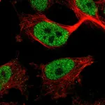 Atlas Antibodies Anti-ZBTB21 Antibody