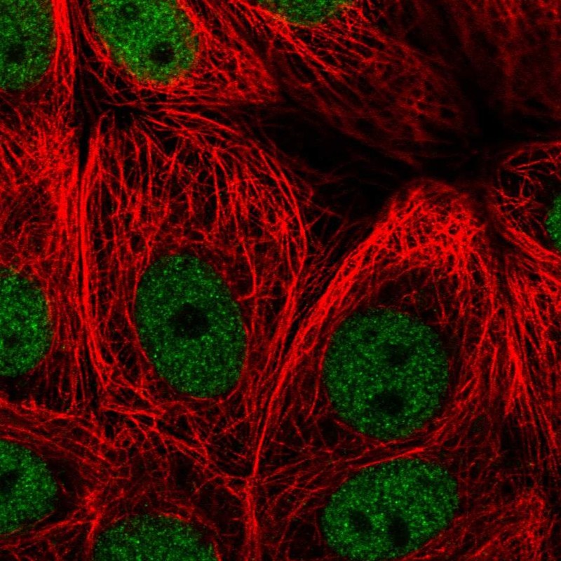 Atlas Antibodies Anti-ZBTB21 Antibody