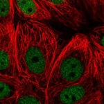 Atlas Antibodies Anti-ZBTB21 Antibody