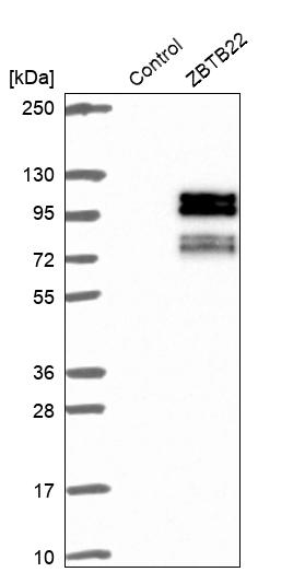 Atlas Antibodies Anti-ZBTB22 Antibody
