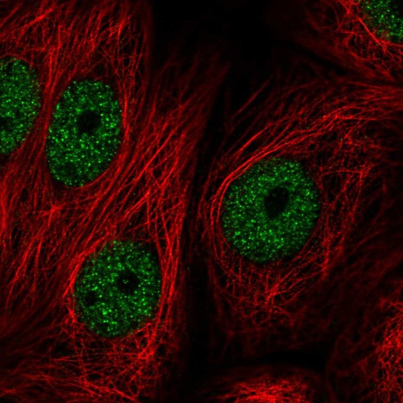 Atlas Antibodies Anti-ZBTB21 Antibody