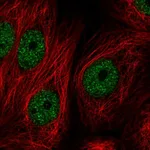 Atlas Antibodies Anti-ZBTB21 Antibody
