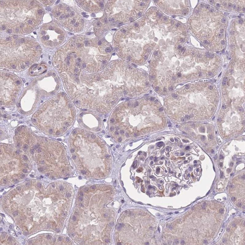 Atlas Antibodies Anti-ZBTB24 Antibody