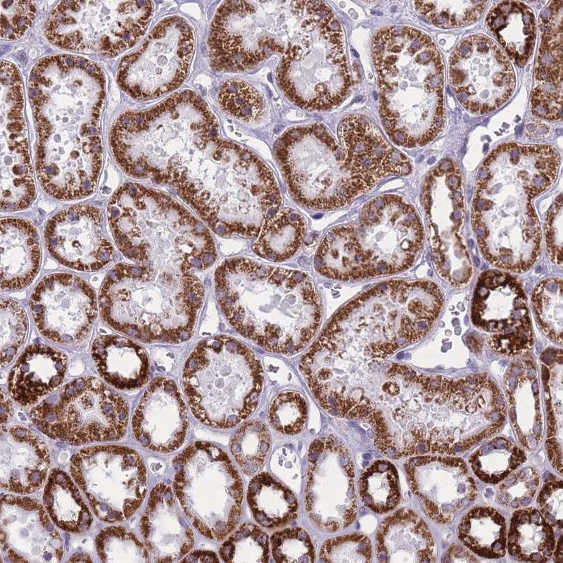 Atlas Antibodies Anti-ZBTB24 Antibody