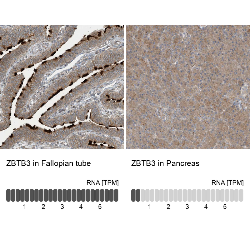 Atlas Antibodies Anti-ZBTB3 Antibody