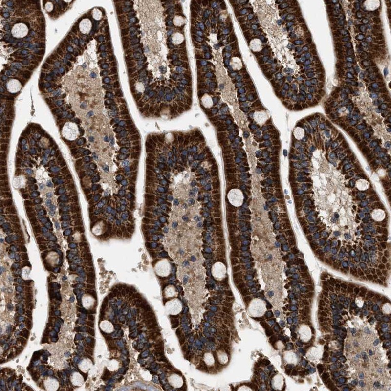 Atlas Antibodies Anti-ZBTB26 Antibody