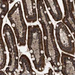 Atlas Antibodies Anti-ZBTB26 Antibody
