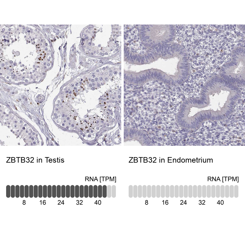 Atlas Antibodies Anti-ZBTB32 Antibody