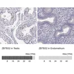 Atlas Antibodies Anti-ZBTB32 Antibody
