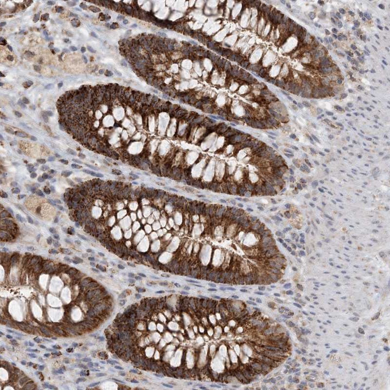 Atlas Antibodies Anti-ZBTB3 Antibody