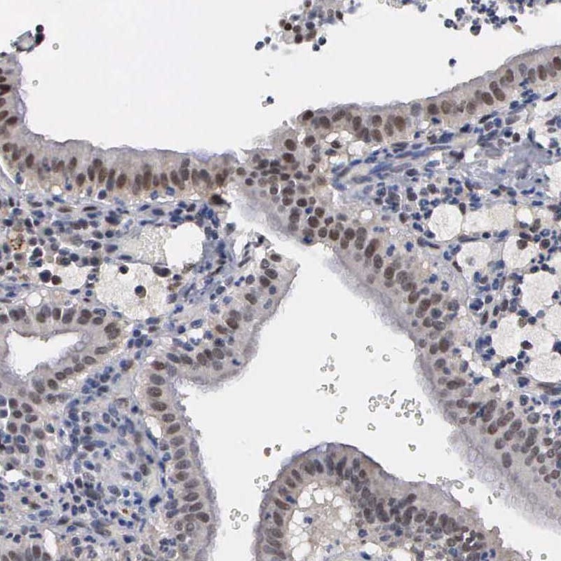 Atlas Antibodies Anti-ZBTB33 Antibody