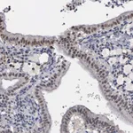 Atlas Antibodies Anti-ZBTB33 Antibody