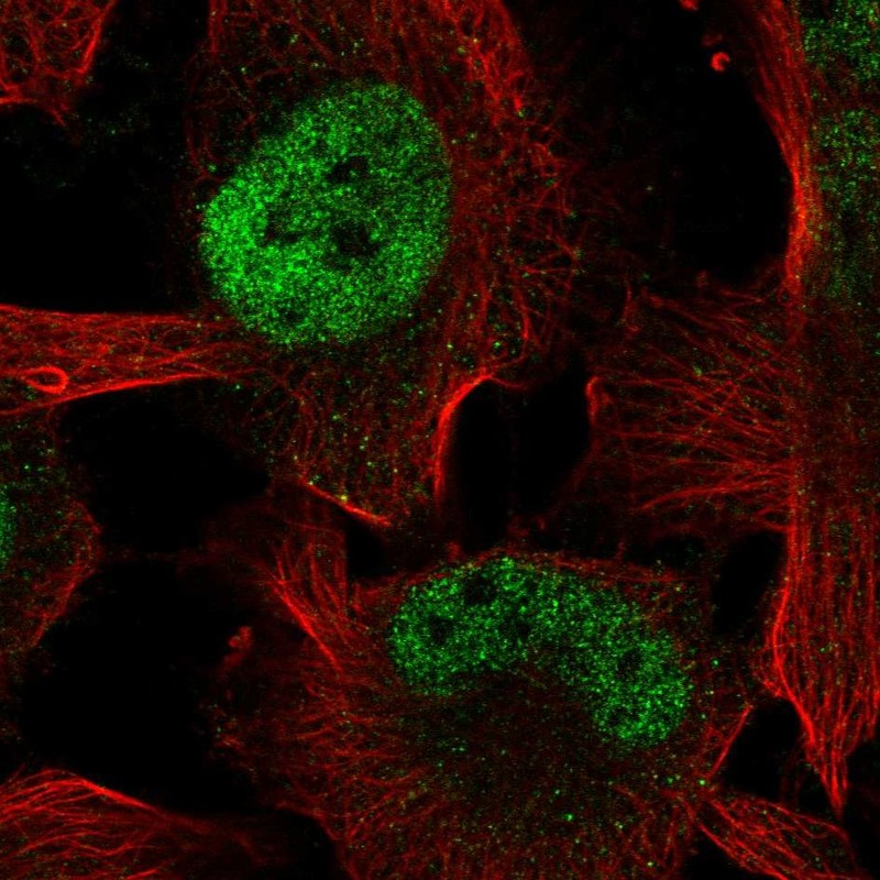 Atlas Antibodies Anti-ZBTB38 Antibody