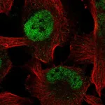Atlas Antibodies Anti-ZBTB38 Antibody