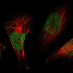 Atlas Antibodies Anti-ZBTB38 Antibody