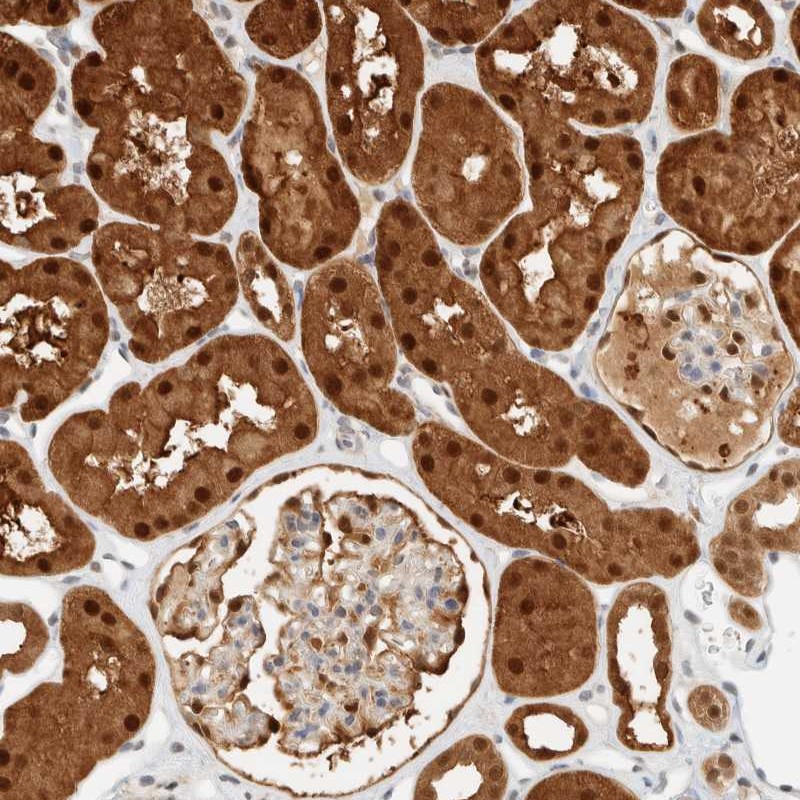 Atlas Antibodies Anti-ZBTB37 Antibody