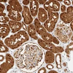 Atlas Antibodies Anti-ZBTB37 Antibody