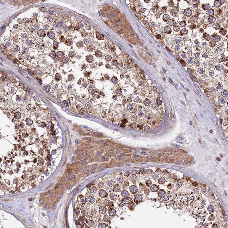 Atlas Antibodies Anti-ZBTB39 Antibody