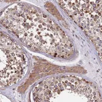 Atlas Antibodies Anti-ZBTB39 Antibody